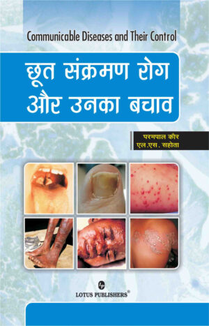 Communicable Diseases | Lotus Publishers